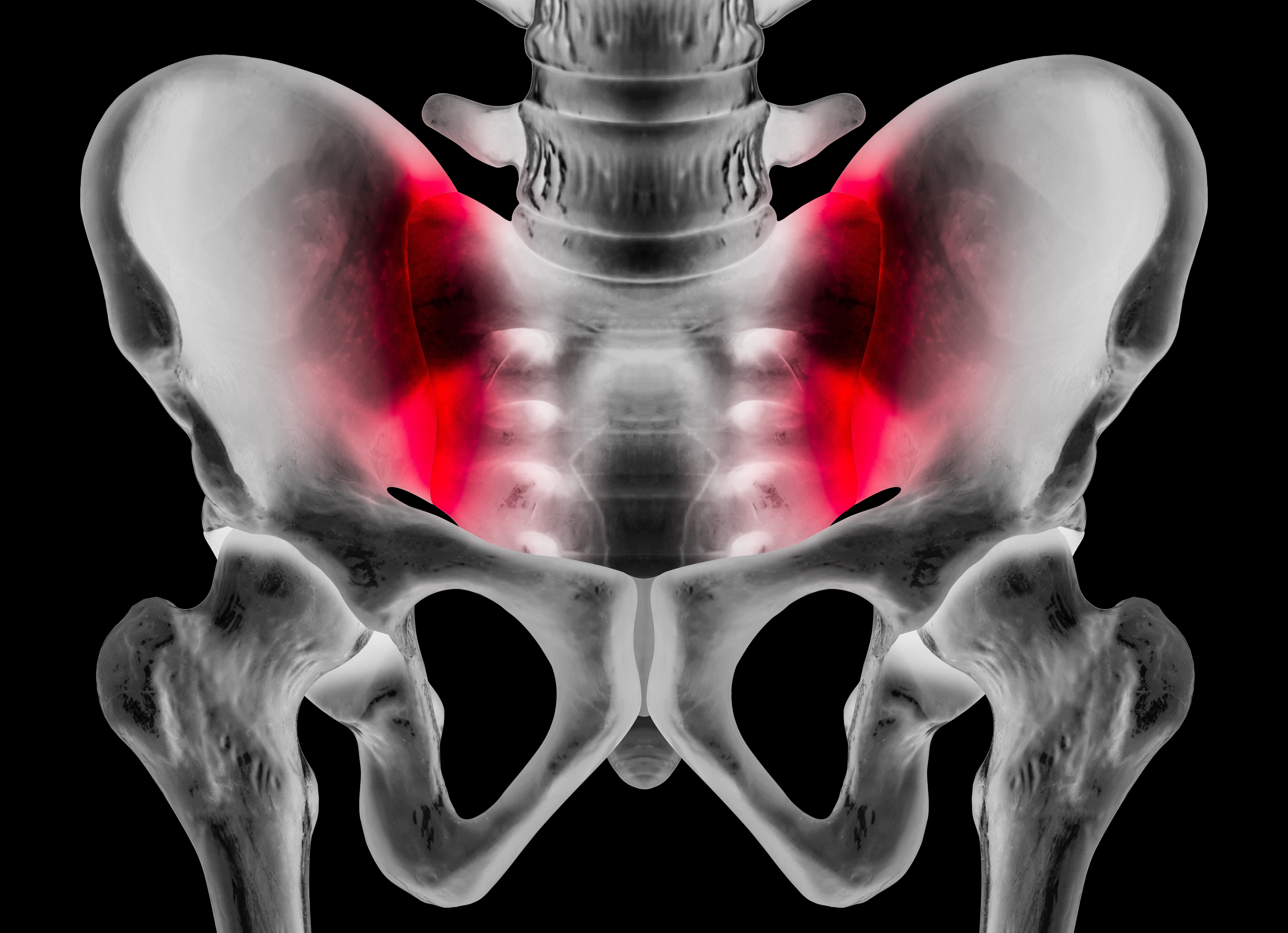 SI Joint Injection Procedure